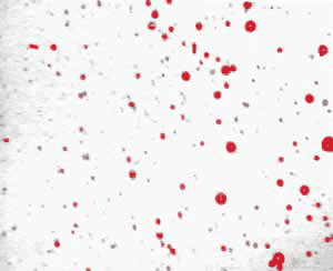 Selecting the oil droplets using intensity thresholding